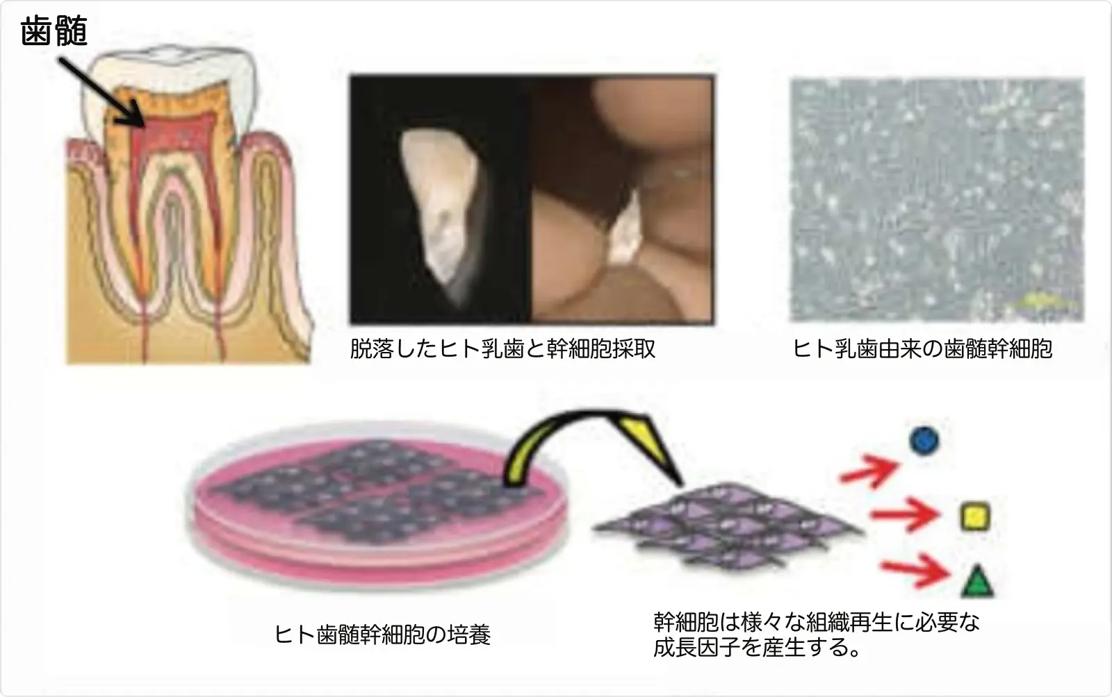 図2：歯髄幹細胞